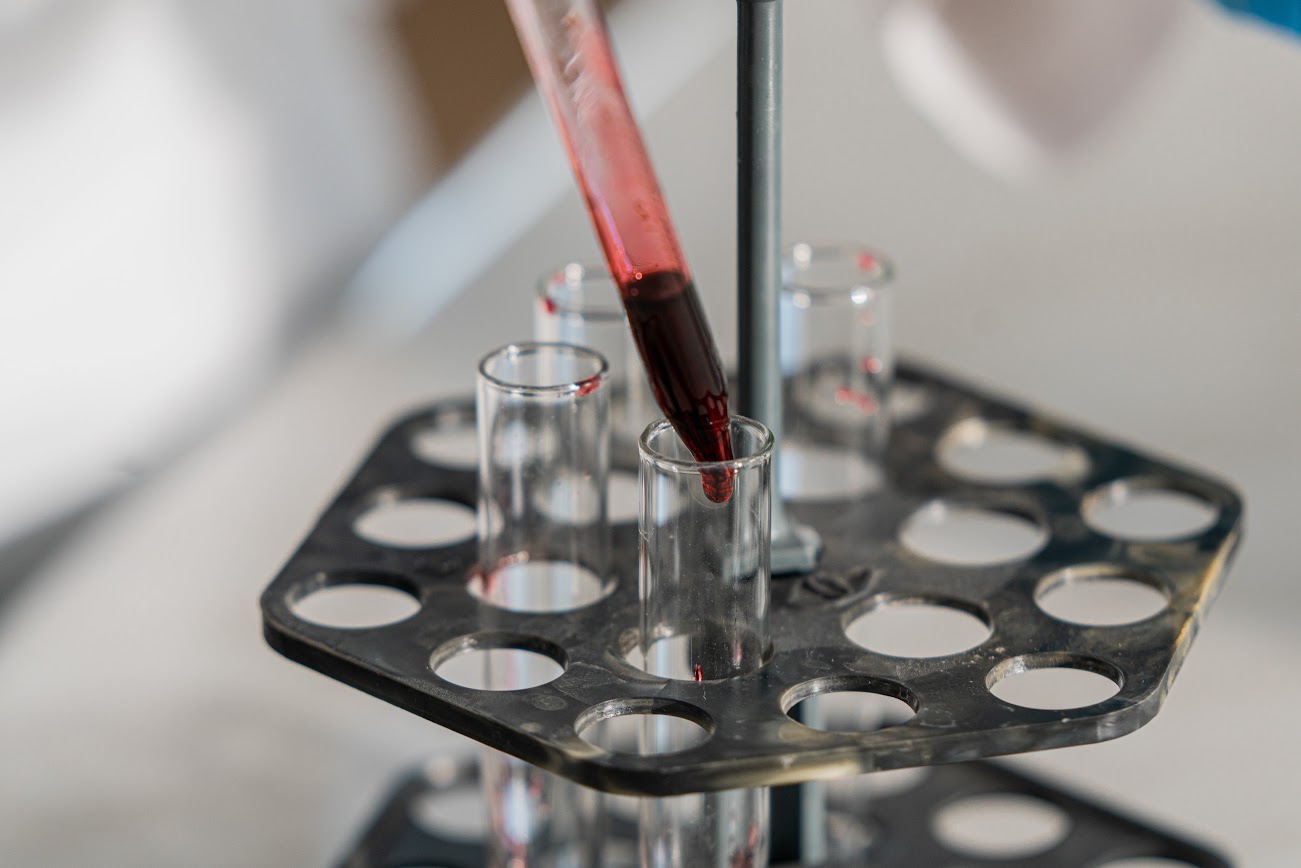 Comprehensive Blood Analysis  Eugene, OR 